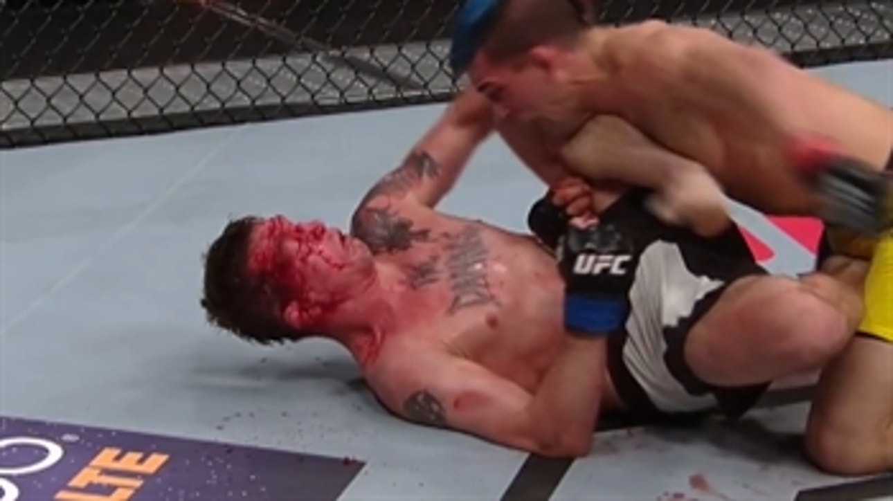 Darren Elkins proved he is tougher than all of us