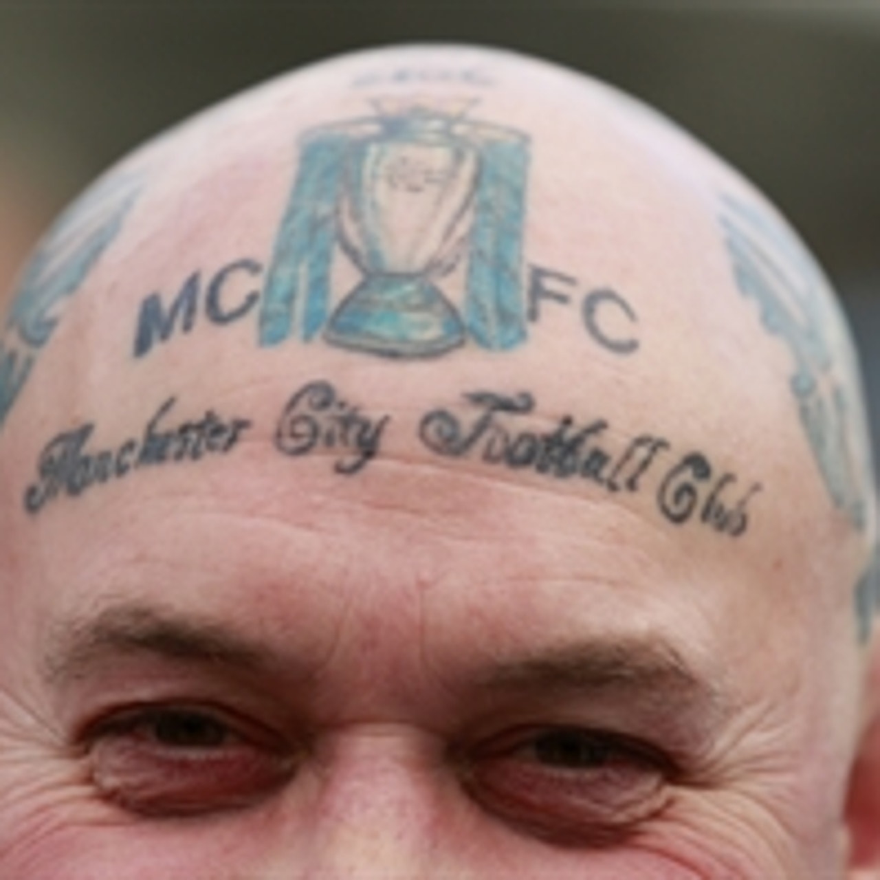 Man City could offer fans free tattoo removal | FOX Sports