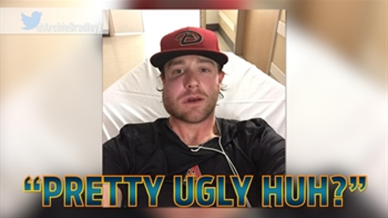 Archie Bradley tweets 'ugly' photo from hospital after being hit in face by line drive
