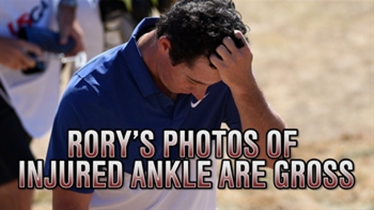 Rory McIlroy's injured ankle is gross