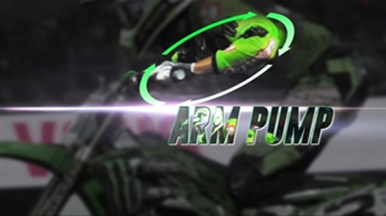 The Science of Supercross: The Arm Pump ' 2017 Monster Energy Supercross