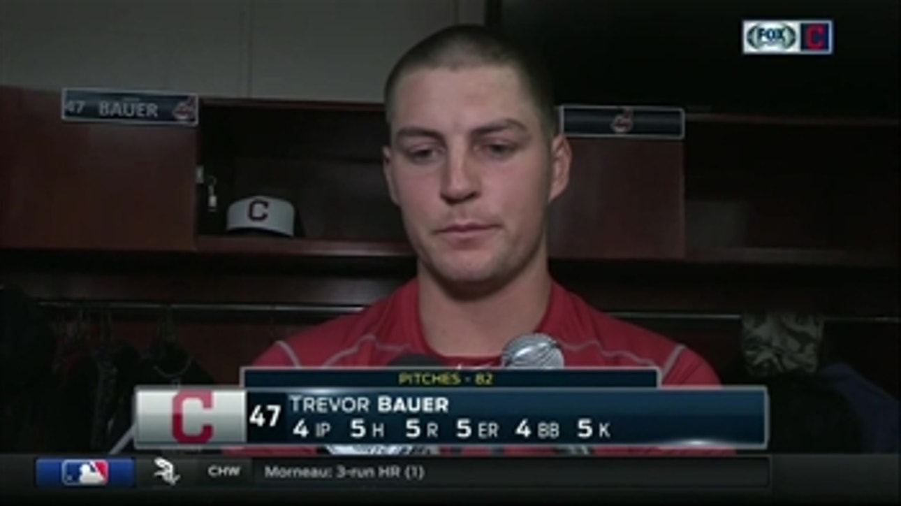 Bauer upset with himself after loss to the O's