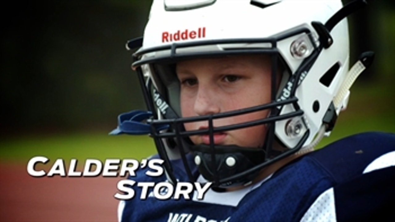 Calder's Story: The Amazing Story of Double Amputee Football Player Calder Hodge