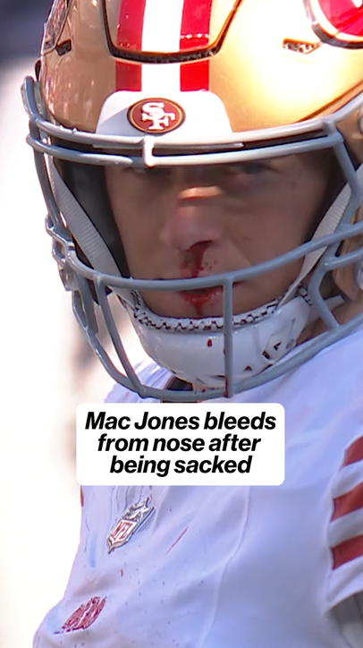 Mac Jones was playing with a bloody nose 😳