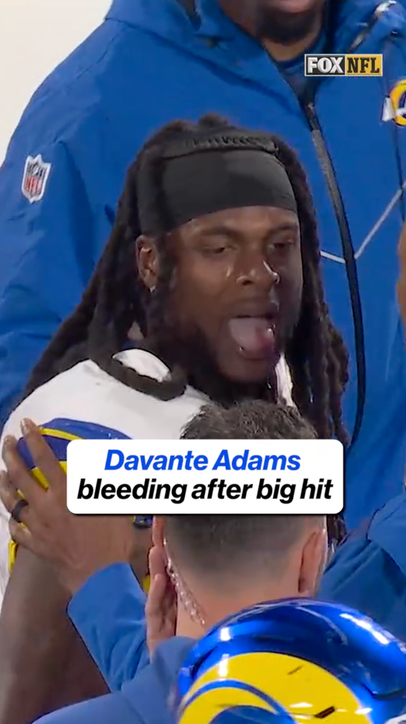 Adams bleeding from tongue after hit 