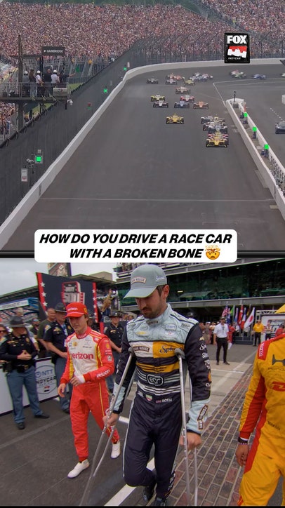 Alexander Rossi underwent outpatient procedures to his right ankle after crash on Monday 😳 