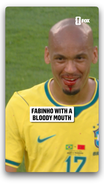 Fabinho was all smiles after being bloodied