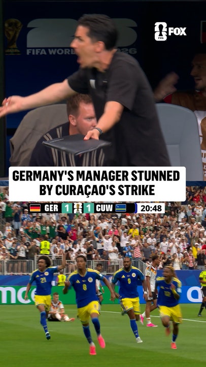 NAGELSMANN IS STUNNED 😳