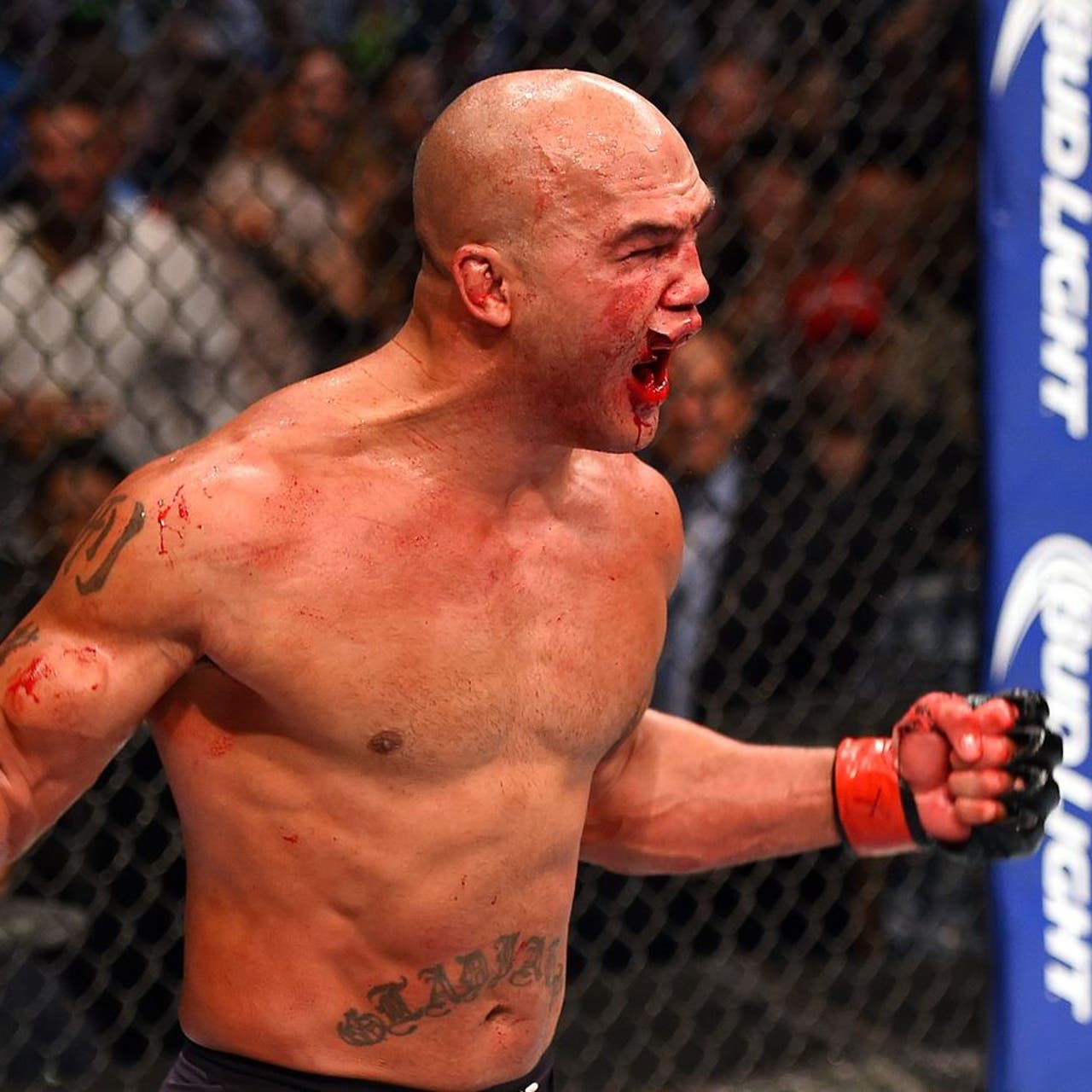 5d06af9a-072816-lawler-cut-lip.jpg