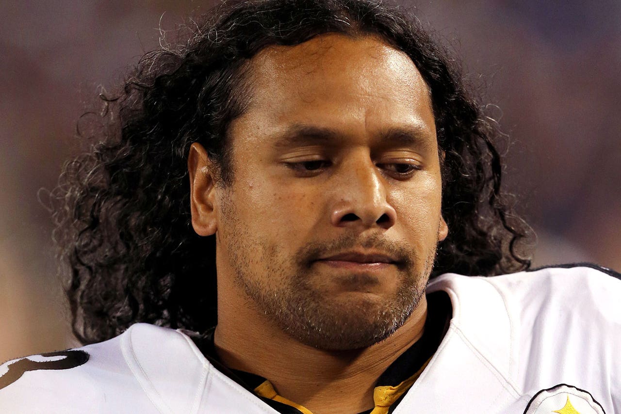 Steelers Safety Polamalu Out Vs. Jets With Knee Injury | FOX Sports