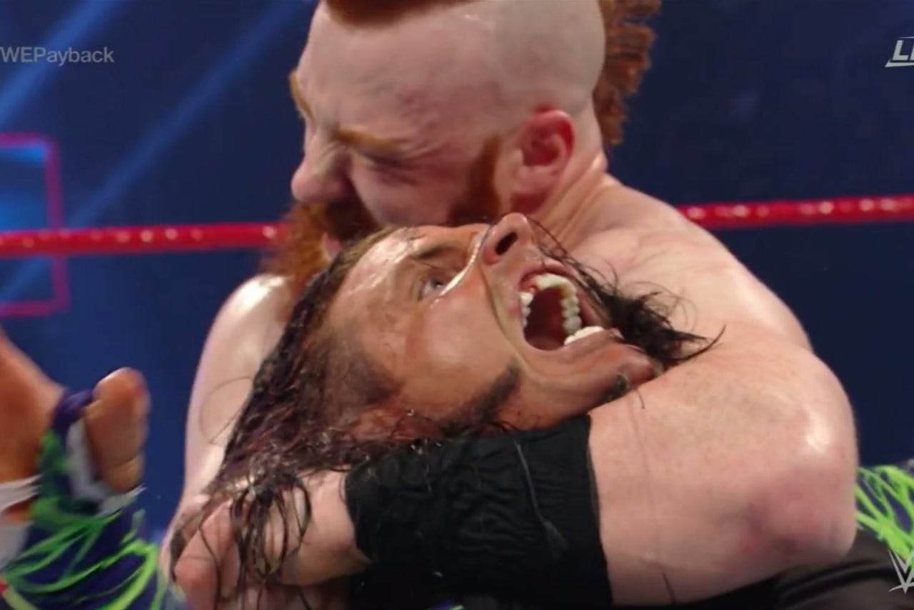 WWE star Jeff Hardy lost a tooth at Payback FOX Sports
