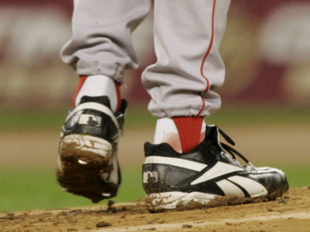 Curt Schilling shares gruesome photo of his 2004 World Series ankle injury