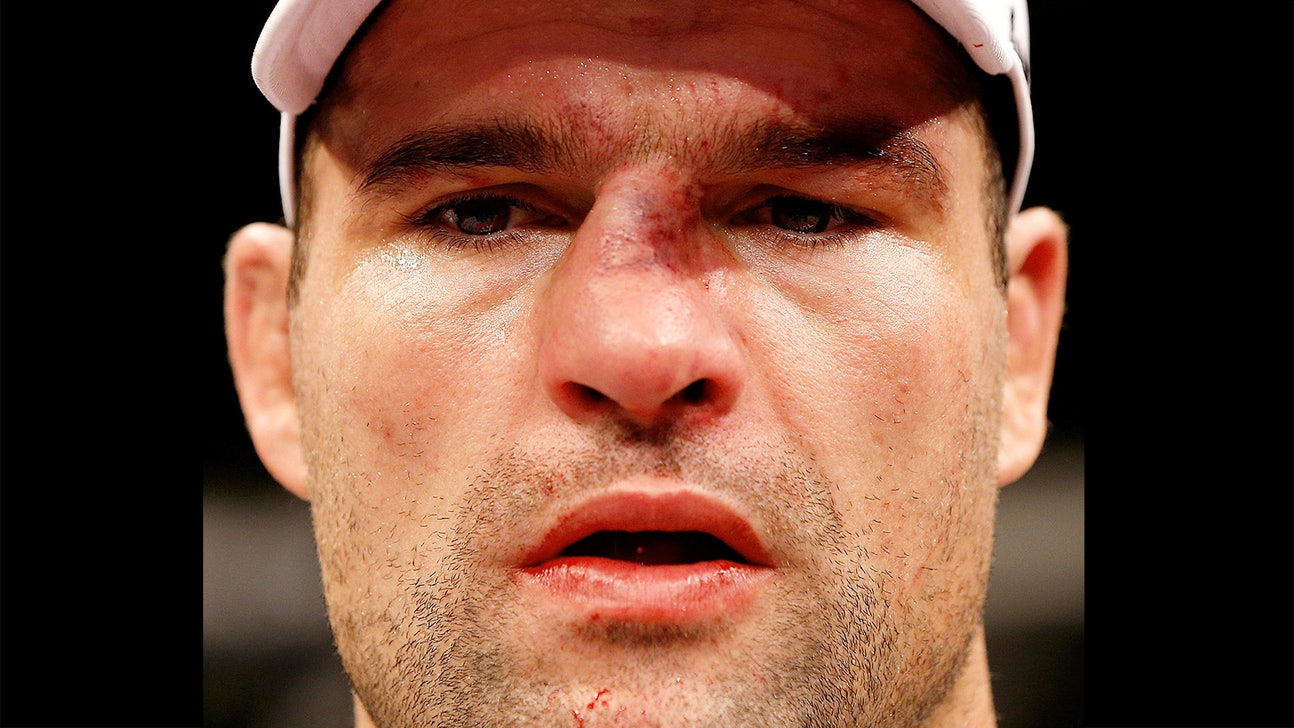 Shogun Rua will have surgery to fix broken nose this week