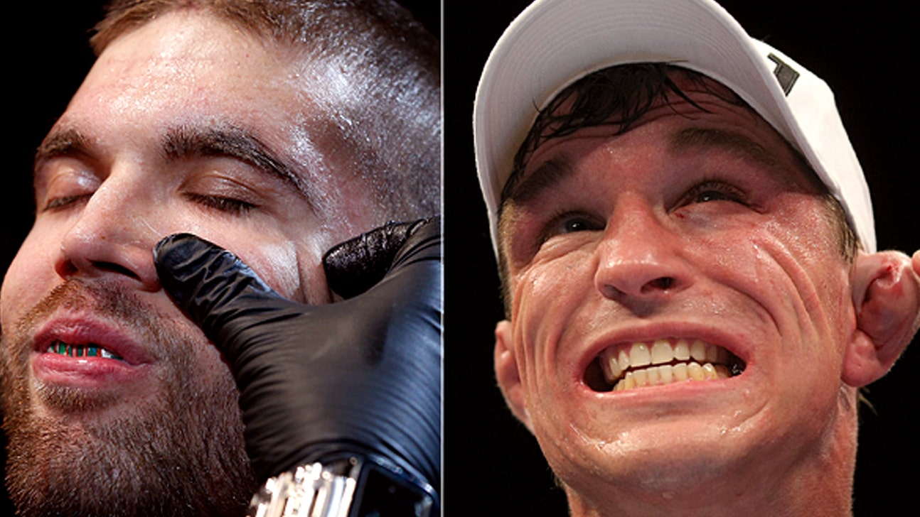 Stephens vs. Elkins verbally agreed for UFC On FOX 10