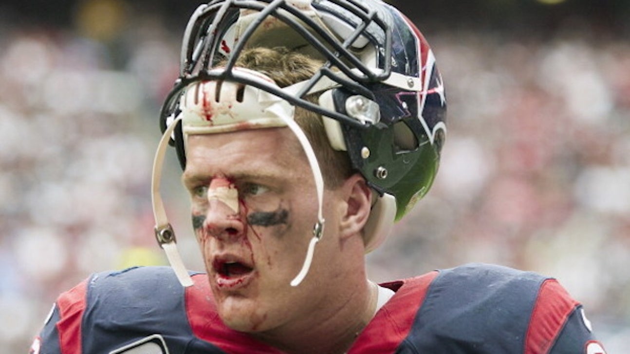 J.J. Watt shows off horrifying photo of ghastly leg bruise