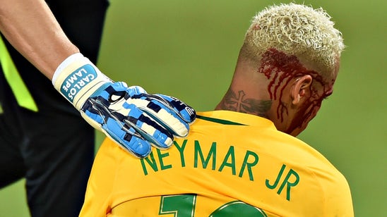Neymar ended up with a bloody head in Brazil's World Cup qualifying win