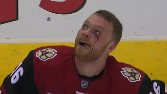 Coyotes' Domi out indefinitely after hand surgery