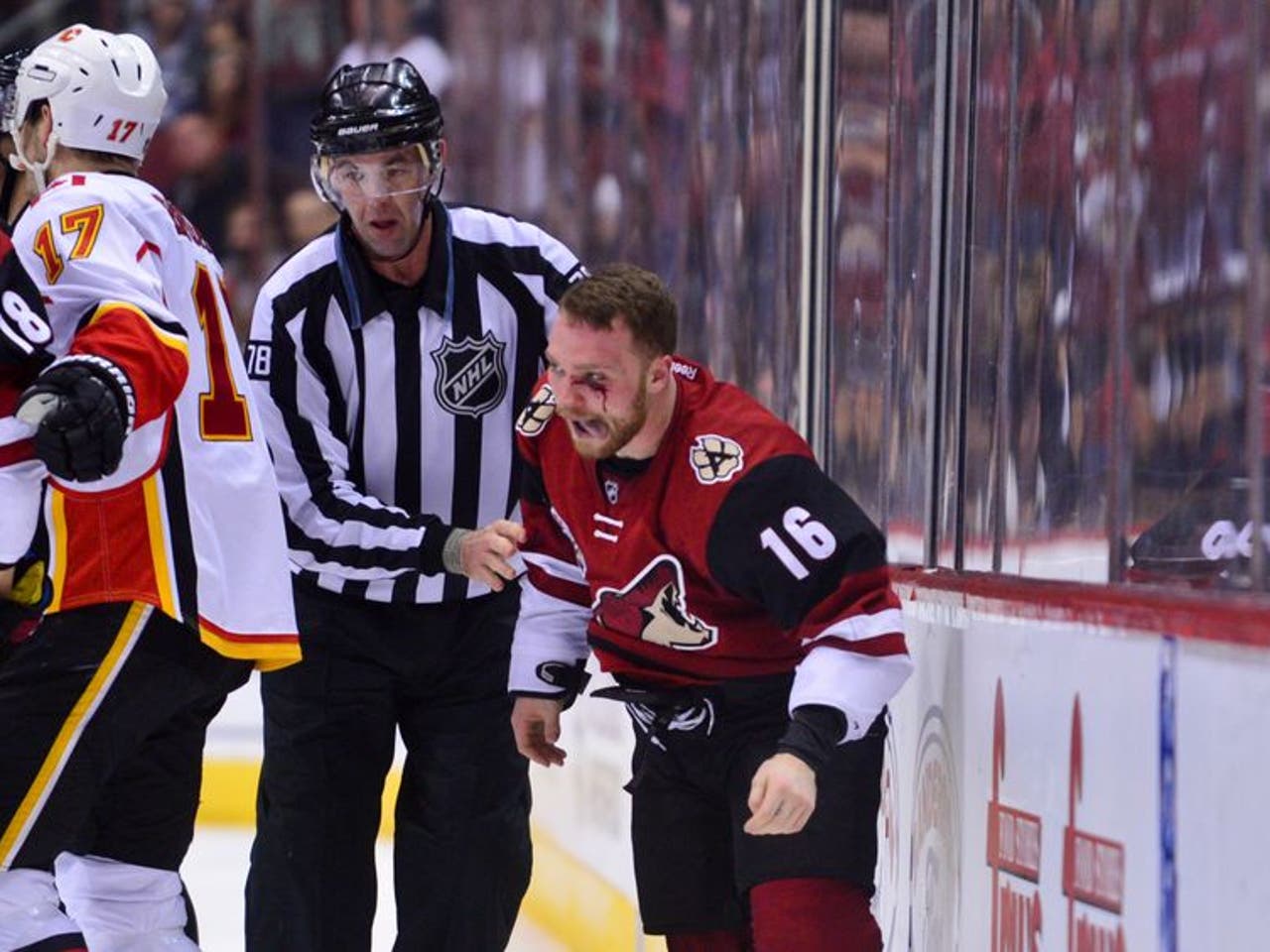 Tuukka Rask punching Joffrey Lupul : r/hockey