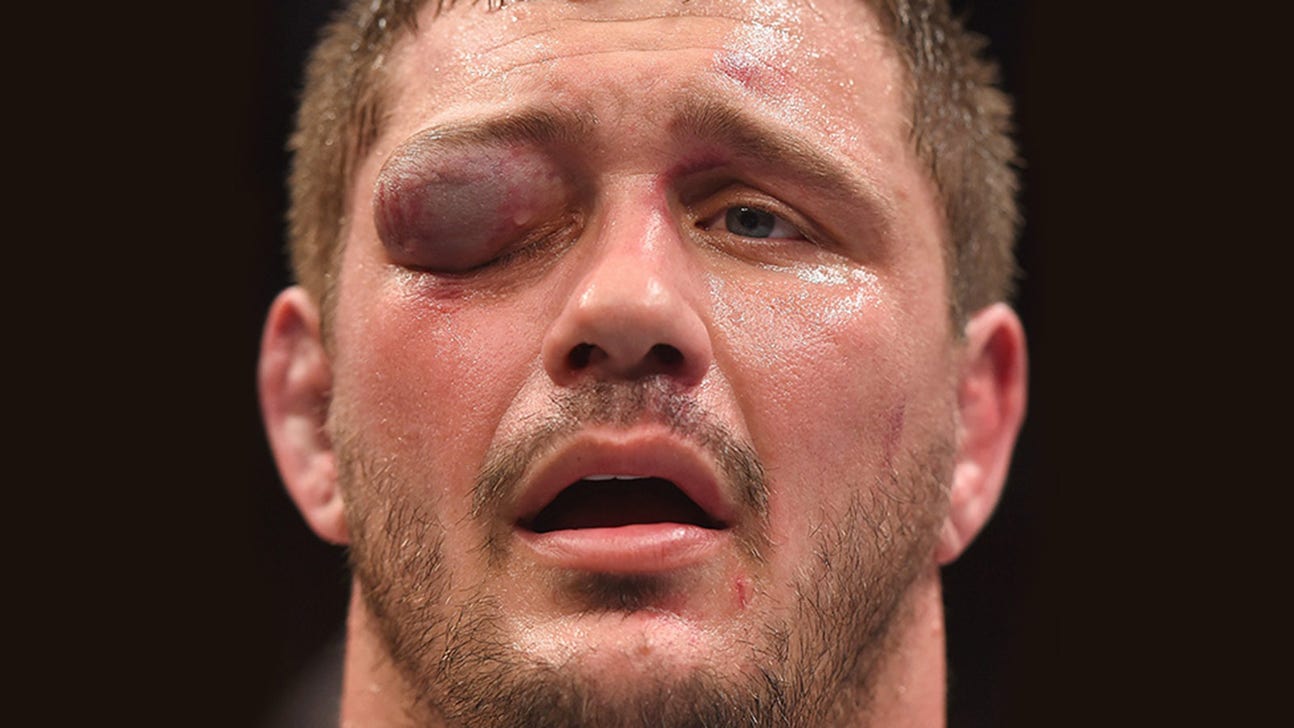 How did this happen to Matt Mitrione's eye?