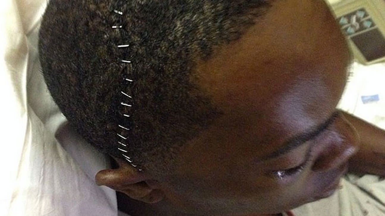 Chapman posts scary post-surgery photo of his head