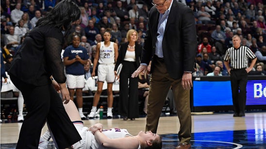 UConn forward Kyla Irwin's season over with fractured elbow