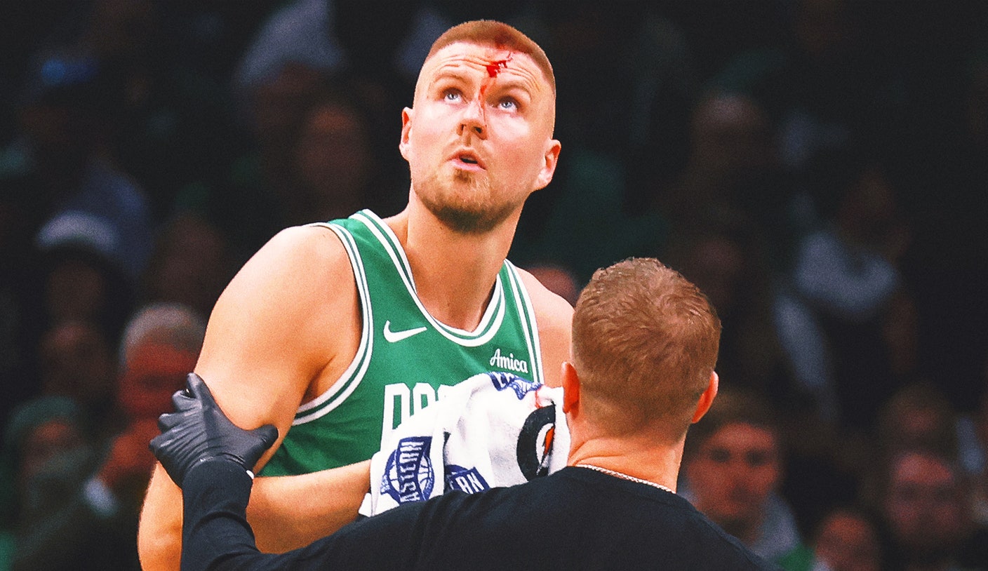 Kristaps Porzingis bloodied as Celtics take 2-0 series lead over Magic
