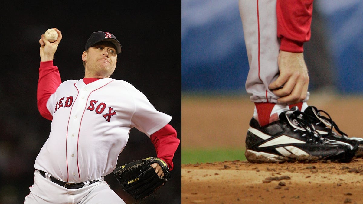 Curt Schilling and his bloody sock at Game 6 of the ALCS would go down in baseball lore. (Getty Images)