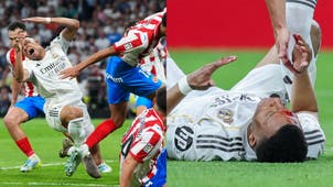 BARCELONA Trending Image: That's Gotta Hurt! Real Madrid's Kylian Mbappé Left With Bloody Gash