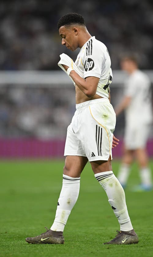 That's Gotta Hurt! Real Madrid's Kylian Mbappé Left With Bloody Gash